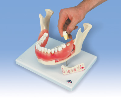 Survival Technology - Dental Models