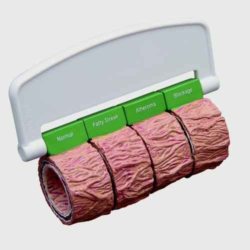 Artery-sections-4-oversized-with-Handle