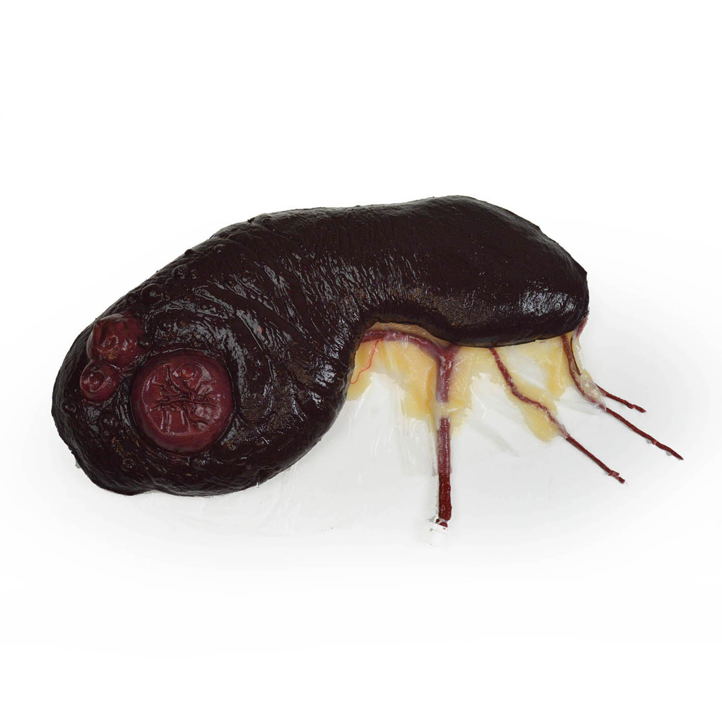 Canine Spleen wPathologies (Vascularized)
