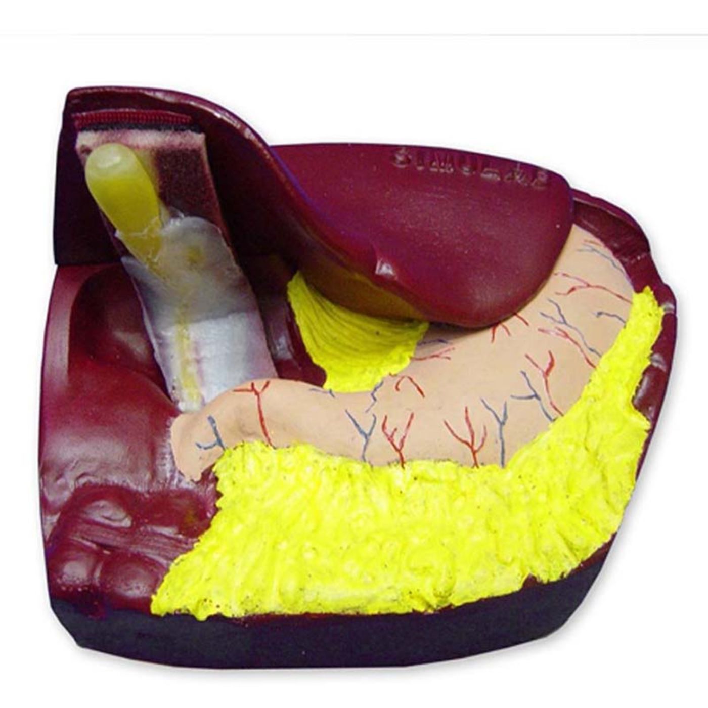 Laparoscopic Cholecystectomy Model