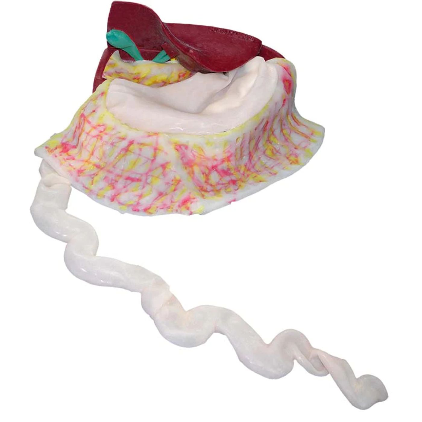 Laparoscopic Cholecystenterostomy Model