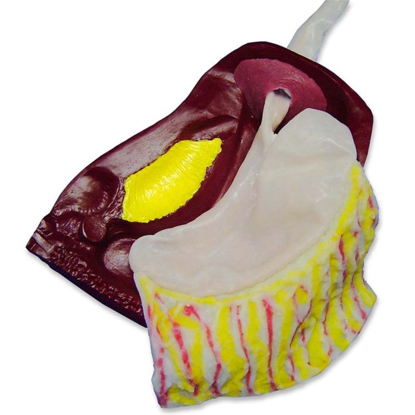 Laparoscopic Nissen Fundoplication Model