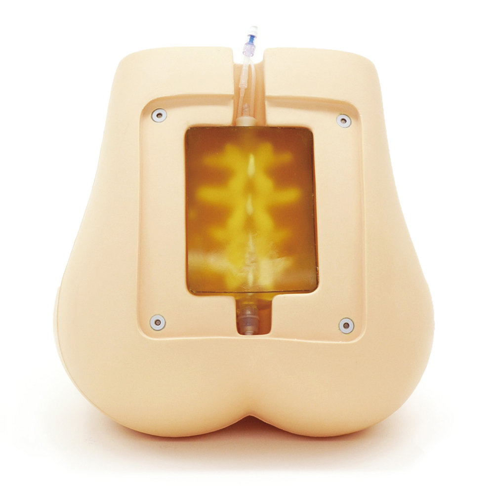 Ultrasound Compatible Lumbar Puncture  Epidural Simulator