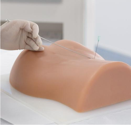 epidural