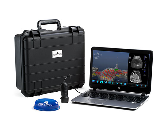 sonosim_edition_rev_550x411