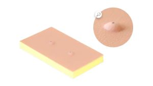 Sebaceous Cyst Pad