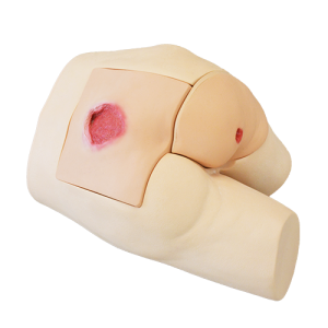 MW63  Pressure Sores Simulator