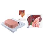 Gallbladder Set