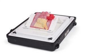 Vermiform Appendix - Normal Anatomy