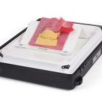 Vermiform Appendix - Post-ileal