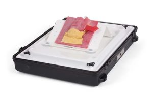 Vermiform Appendix - Post-ileal