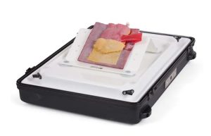 Vermiform Appendix - Retrocecal