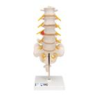 Human Lumbar Spinal Column Model with Dorso-Lateral Prolapsed Intervertebral Disc
