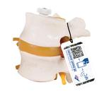 2 Human Lumbar Vertebrae with Prolapsed Disc, Flexibly Mounted