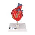 Classic Human Heart Model with Bypass, 2 pa