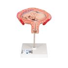 Fetus Model, 4th Month in Abdominal Position