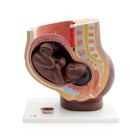 Pregnancy Pelvis Model in Median Section with Removable Fetus (40 weeks), 3 part, dark skin
