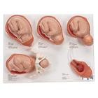 Labor Stages Model, Small
