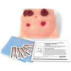 Ostomy Care Model