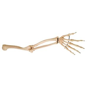 SKU: MG22957  Arm Model, Wire Mounted