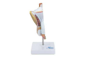 SKU: MG29949  Male Genital Organ with Pathology Model, 2 parts