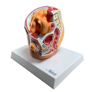 SKU: MG30132 Pelvis with Indirect Inguinal Hernia Model, Half-Size