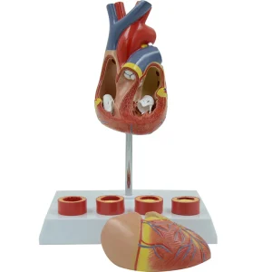 SKU: MG35530 Heart with Arteriosclerosis Model