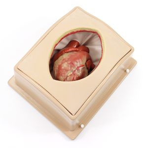 Suitcase Thorax (#1264)