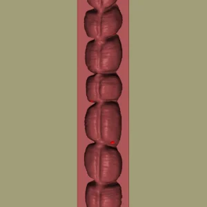 Colon Endoscopy Trainer with Flat Polyps (#2201)