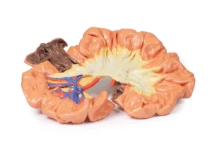 Bowel - Portion of Ileum