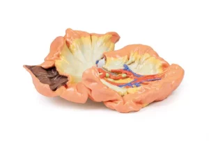 Bowel - Portion of Jejenum
