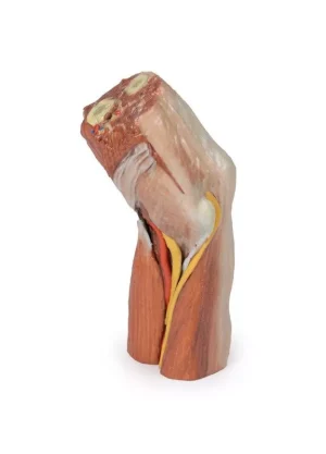 Cubital fossa - muscles, large nerves and the brachial artery