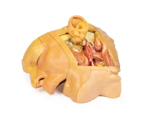 Head and Neck