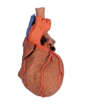 Heart and the distal trachea, carina and primary bronchi
