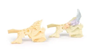 Paranasal Sinus model