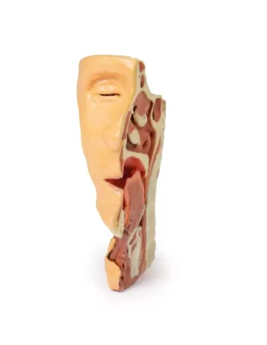 Deep face/Infratemporal fossa