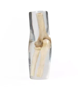 X-Ray Phantom Elbow, transparent