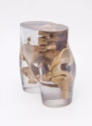 X-Ray phantom pelvis, transparent