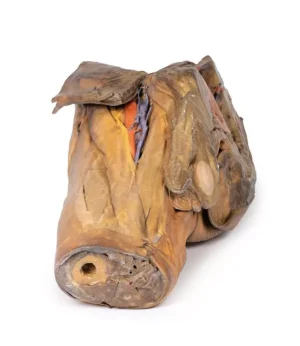 Male hemipelvis and thigh