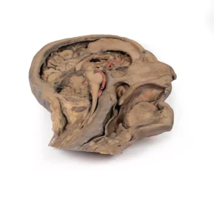 Parasagittal Section of the head and neck