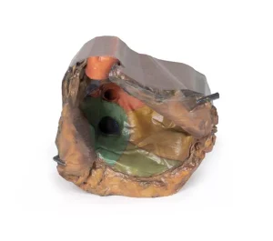 Pericardial space