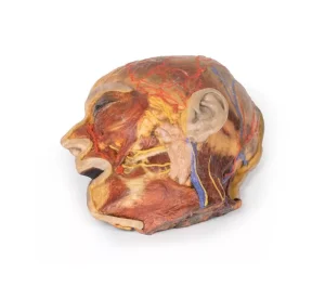 Superficial Facial nerves & Parotid Gland