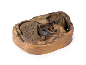 Thoracic cross section at T6